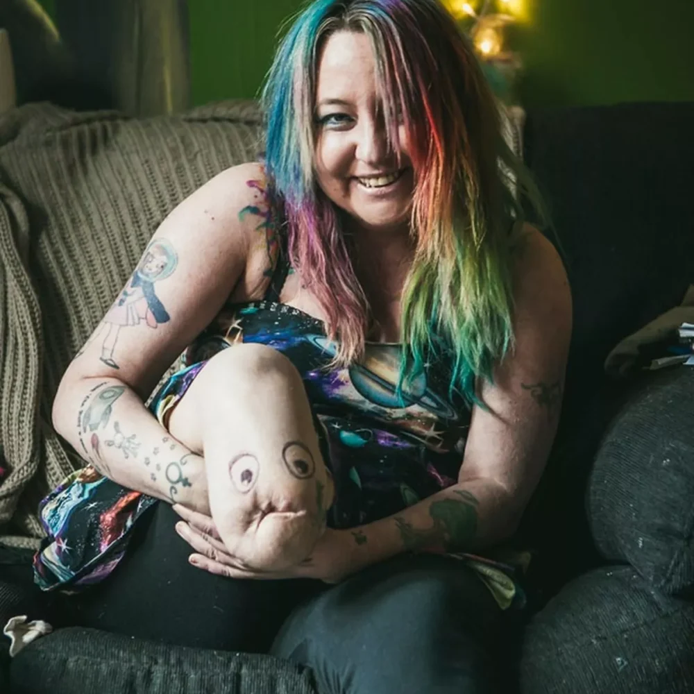 Jackie sits in an arm chair smiling. She is holding her amputated leg out in front of her to show the face she has drawn on the stump. 